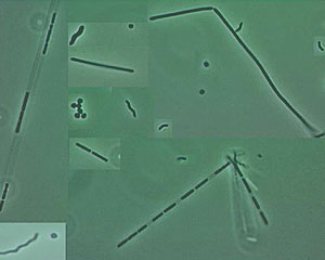 Thermophiles, as seen under the microscope. These rod- and circle-shaped microbes were collected at hydrothermal vents in the Pacific Ocean. They look much like the thermophiles we have seen in the Indian Ocean. Their actual size is 1 to 2 microns. 