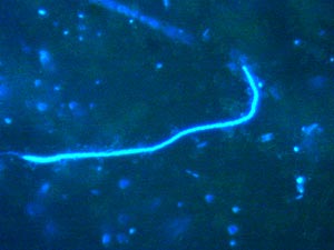  A photomicrograph (1000 times magnification) of stained bacterial cells. These were isolated from a sample &ldquo;slurped&rdquo; from around a clump of mussels. The long strand is a spirochete&mdash;a bacterium that moves in a corkscrew motion. The bright dots are also bacteria; however, they cannot be identified without the use of molecular techniques. 