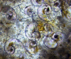 In this close-up image of a salp fecal pellet you can see the microscopic shells of larval pteropods, which are planktonic snails that live in the open ocean.