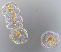 diatom Stellarima