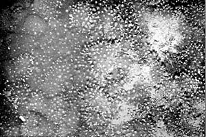 An electronic still camera image of the area of diffuse hydrothermal flow showing the anemone field that is giving the pillow basalts a “peach-fuzz” coating. The white area in the upper right of the photograph is probably bacterial coating that is concentrated where the hydrothermal flow is greatest. Check out the InfoMods on Hydrothermal Chemistry and Biology in the Deeper Discovery part of the web site. The distance across the photograph is about 4 meters.