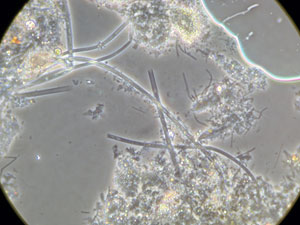 Magnified 400 times under a microscope are the scrapings from the surface of a tubeworm collected from Rosebud. The round, white objects and the short, darker strands could be bacteria. Microbiologists will determine this through genetic studies. (Photo by Kevin Penn)